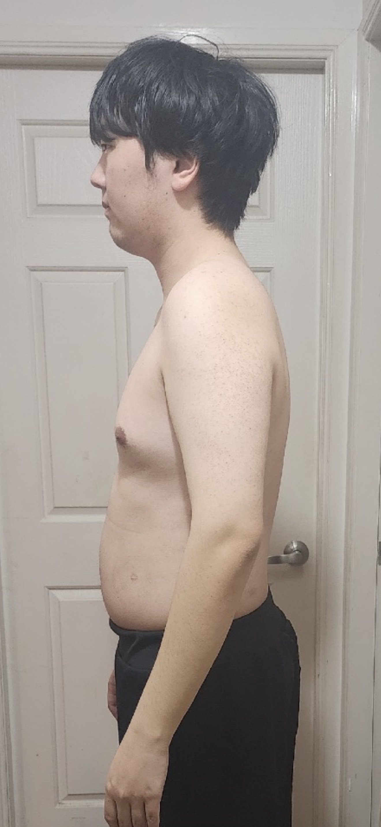 Client 3 Before